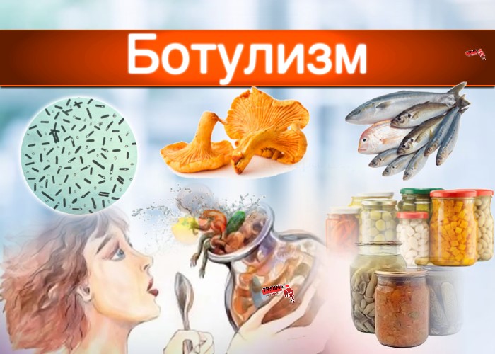 «Ботулизм!»