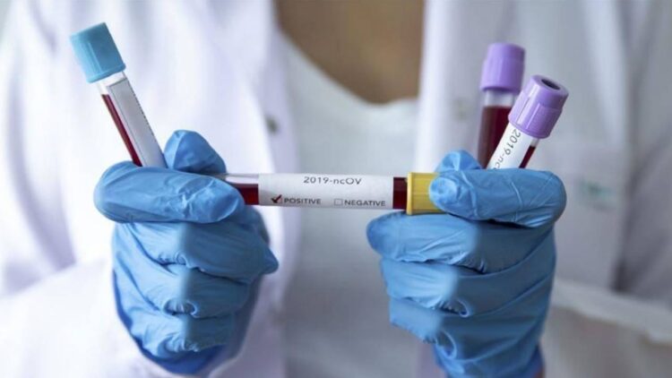 Қостанай облысында коронавирустық инфекция бойынша 30 қарашадағы эпидемиологиялық жағдай туралы ақпарат