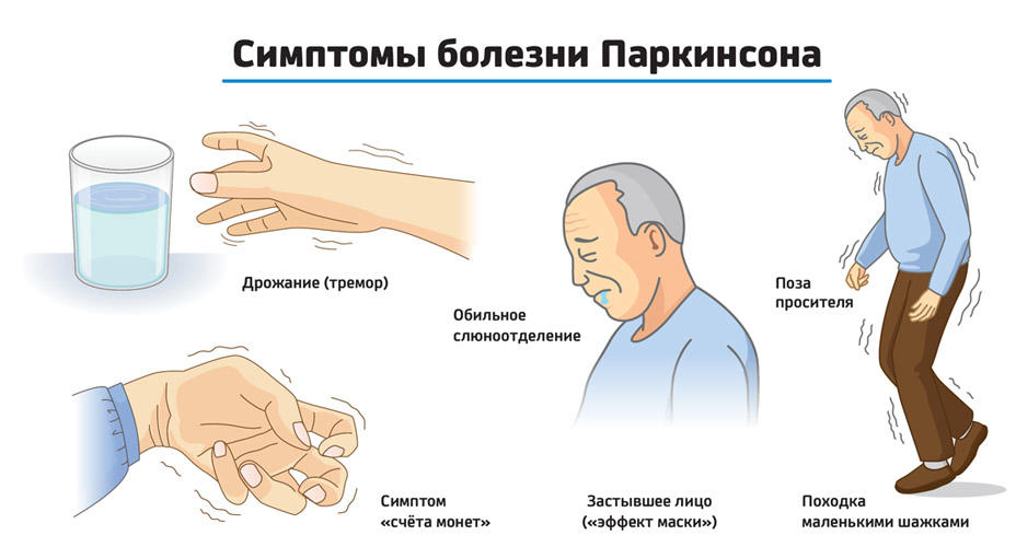 Паркинсон ауруы кезіндегі медициналық-әлеуметтік сараптама және оңалту мәселелері.