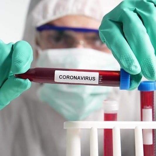 2020 жылғы 22 қарашада Қостанай облысында коронавирустық инфекция бойынша эпидемиологиялық жағдай туралы ақпарат ​