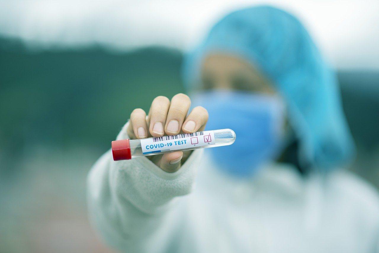 2020 жылғы 23 қарашада Қостанай облысында коронавирустық инфекция бойынша эпидемиологиялық жағдай туралы ақпарат