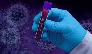 Қостанай облысында коронавирустық инфекция бойынша эпидемиологиялық жағдай туралы ақпарат