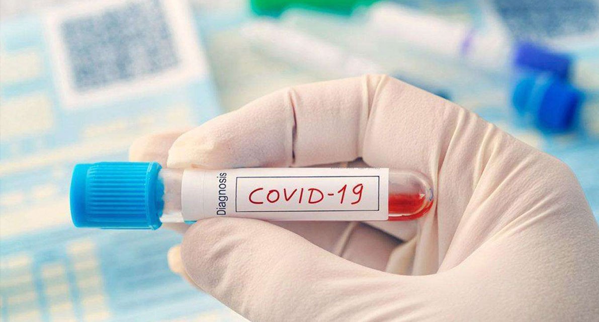 Өткен тәулікте Қызылорда облысында коронавирус инфекциясымен 8 науқас тіркелді