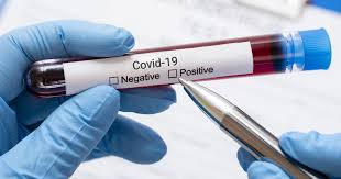 Список лабораторий осуществляющих  диагностику коронавирусной инфекции COVID-19 методом ПЦР по Республике Казахстан по состоянию на 8 июня 2021 год