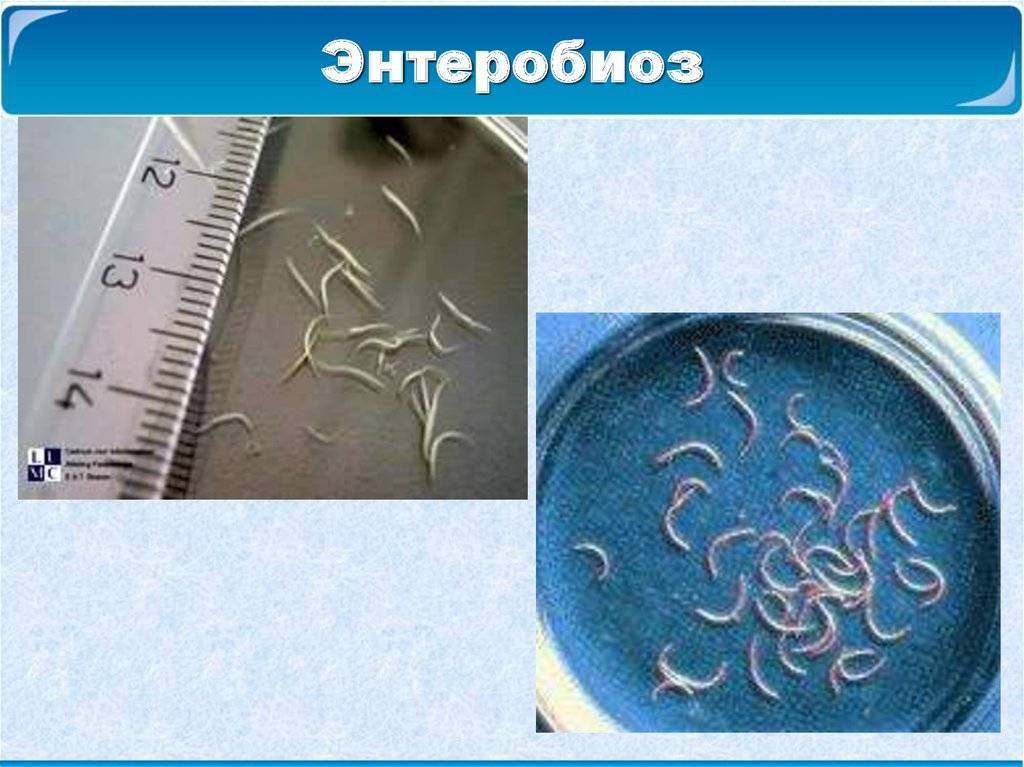 Как выглядят глисты в попе у ребенка