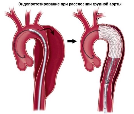 Большие возможности малоинвазивной хирургии