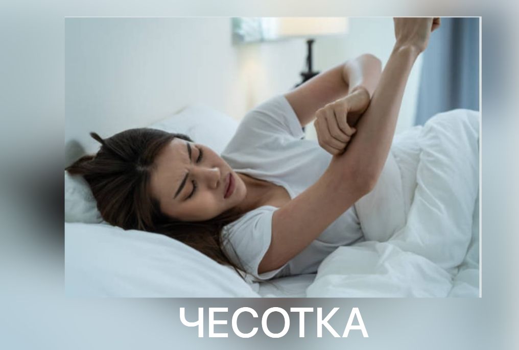 Қышыма: пайда болу себептері, белгілері, алдын-алу