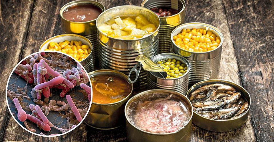 Ботулизмның алдын алу