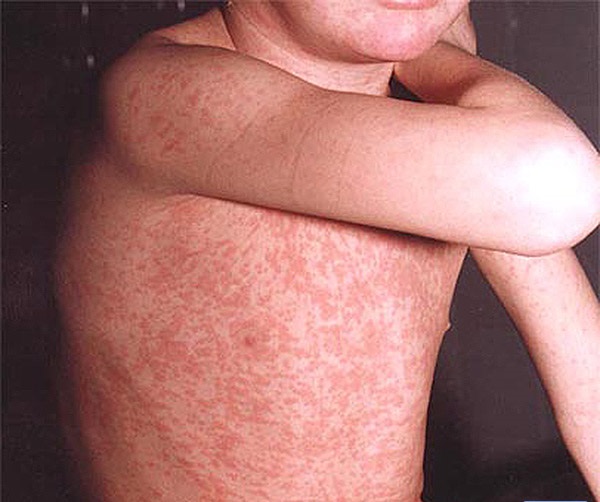 Мөлдір трусики киген киска