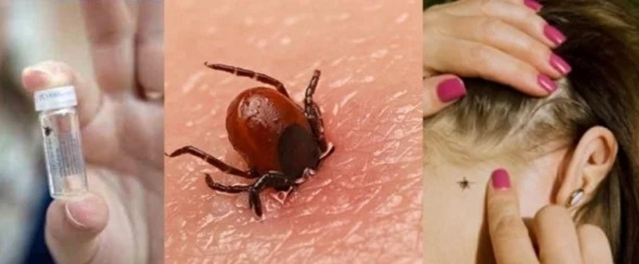 Компиляция сперматозоидтарды жалайды