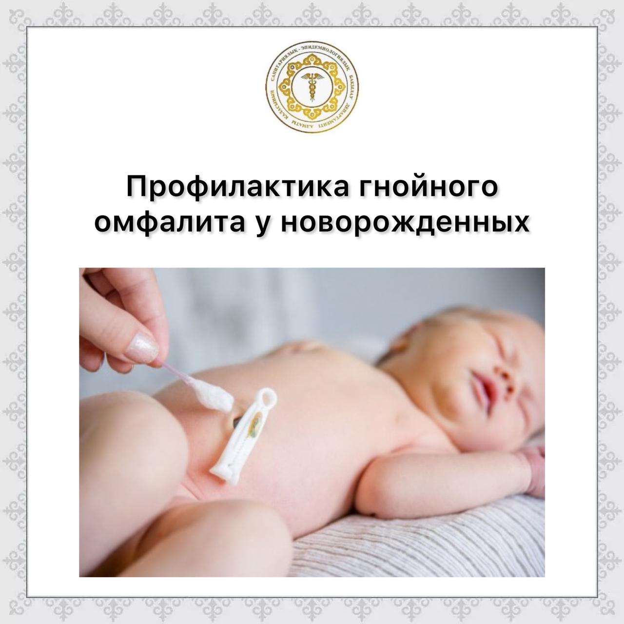 Профилактика гнойного омфалита у новорожденных