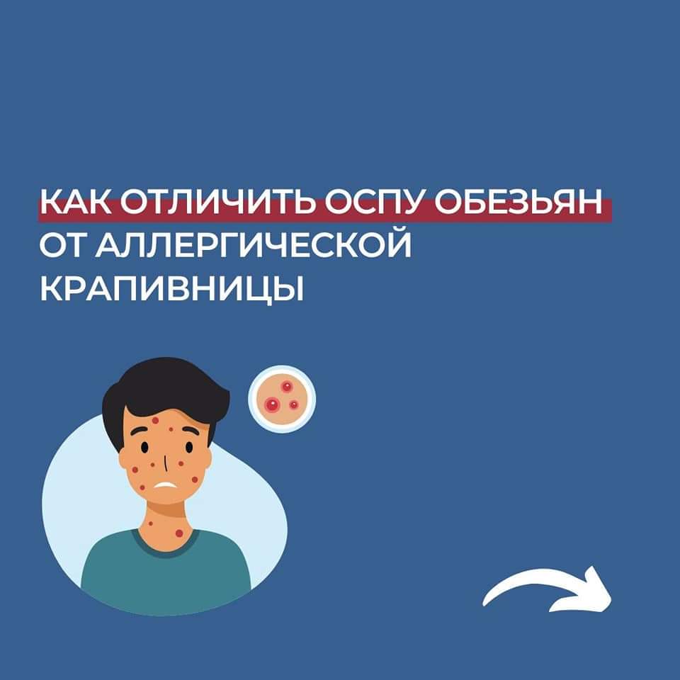 Основные симптомы оспы обезьян