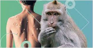 Симптомы и меры лечения оспы обезьяны