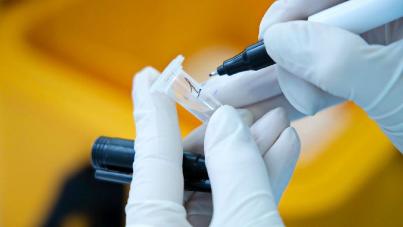За прошедшие сутки зарегистрировано 114 новых случаев заболевания коронавирусной инфекцией, передает Tengrinews.kz со ссылкой на данные Комитета санитарно-эпидемиологического контроля МЗ РК.