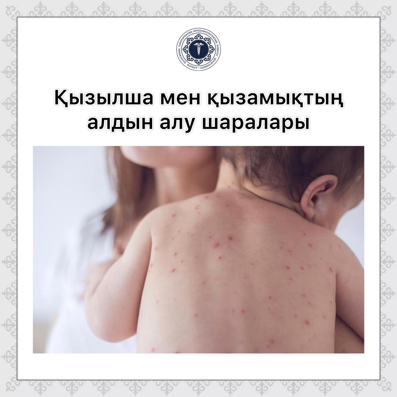 Қызылша мен қызамықтың алдын алу шаралары