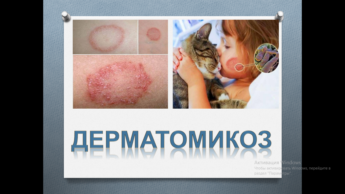 Артқы жағындағы қатты трахты онлайн көру