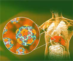 Вирусты  гепатит