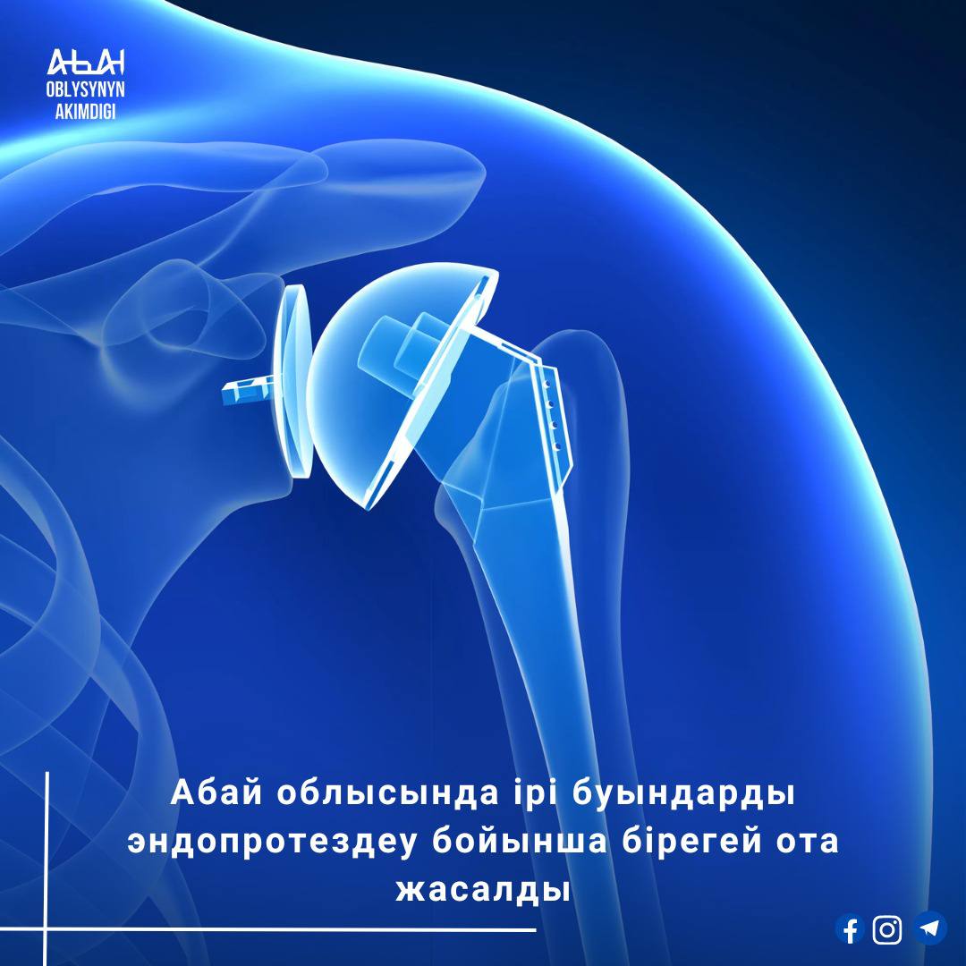 Операция стоимостью более одного миллиона тенге была проведена  бесплатно в системе ОСМС