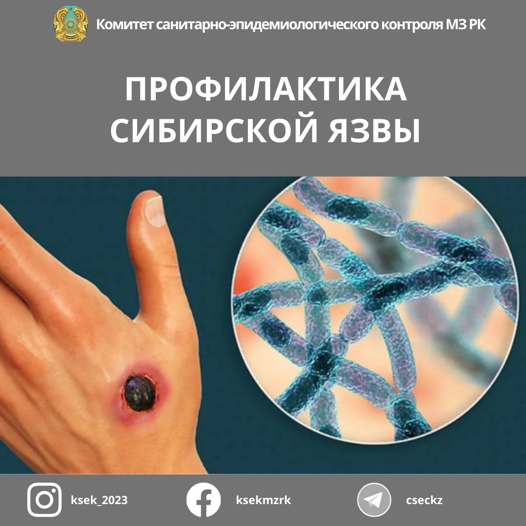 Профилактика сибирской язвы