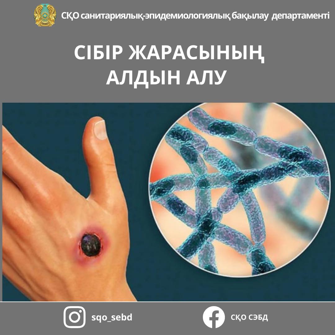 📌Сібір жарасының алдын алу