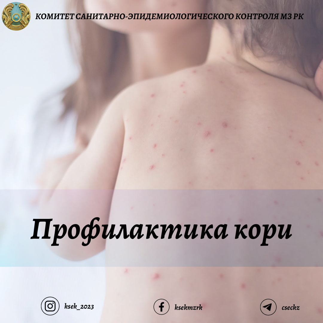 Профилактика кори