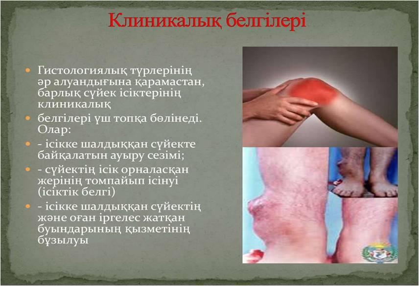 Пастереллездің алдын алу.