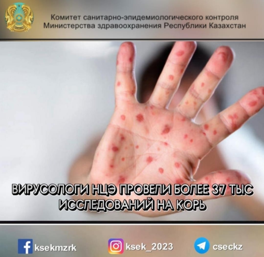 Вирусологи НЦЭ провели более 37 тыс. исследований на корь