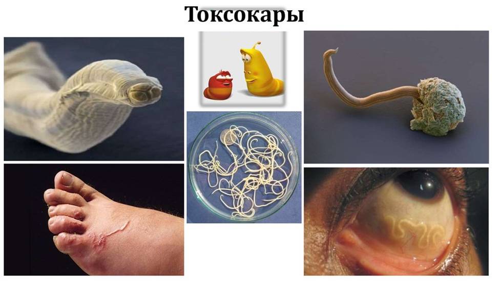 Токсокароз және алдын алу шаралары.