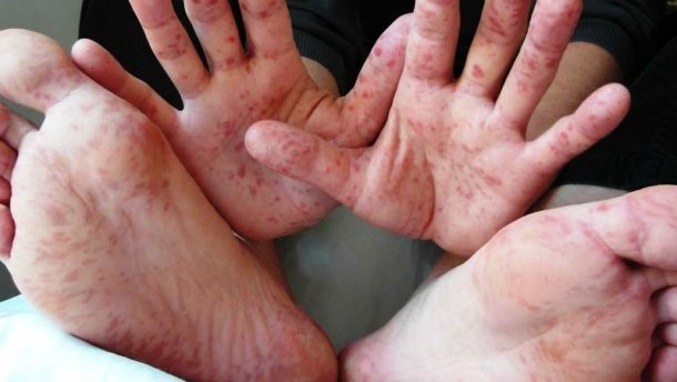 Қыздың жыныстық қатынаста жауапты болатын лауазымдары