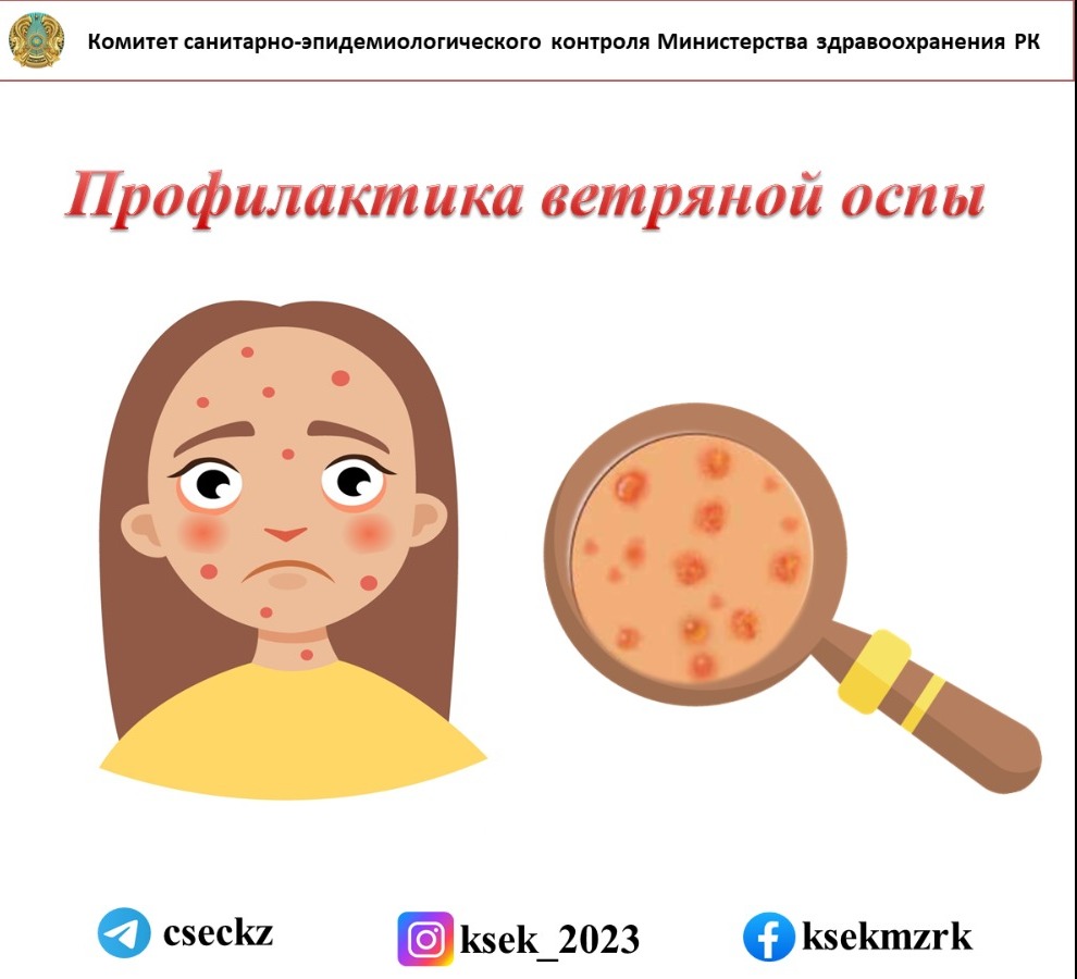 Ветрянка инкубационный период у детей