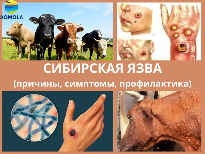 Споры сибирской язвы активны в земле десятки лет