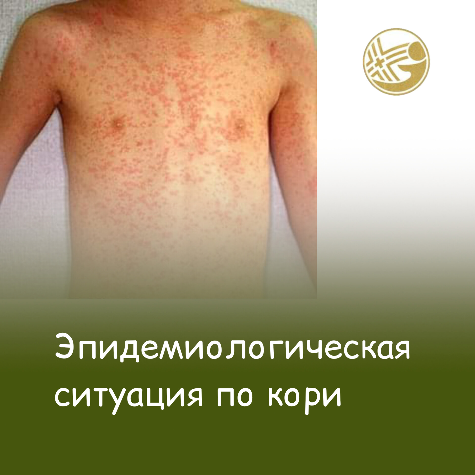 Эротикалық порно және т.б.