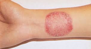 Дик сұмырайдың аузына