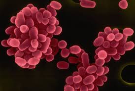 Бруцеллез дегеніміз не?