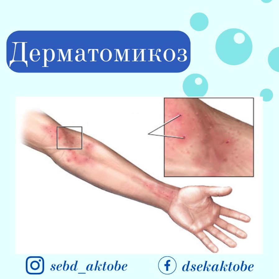 Есектегі секс желім