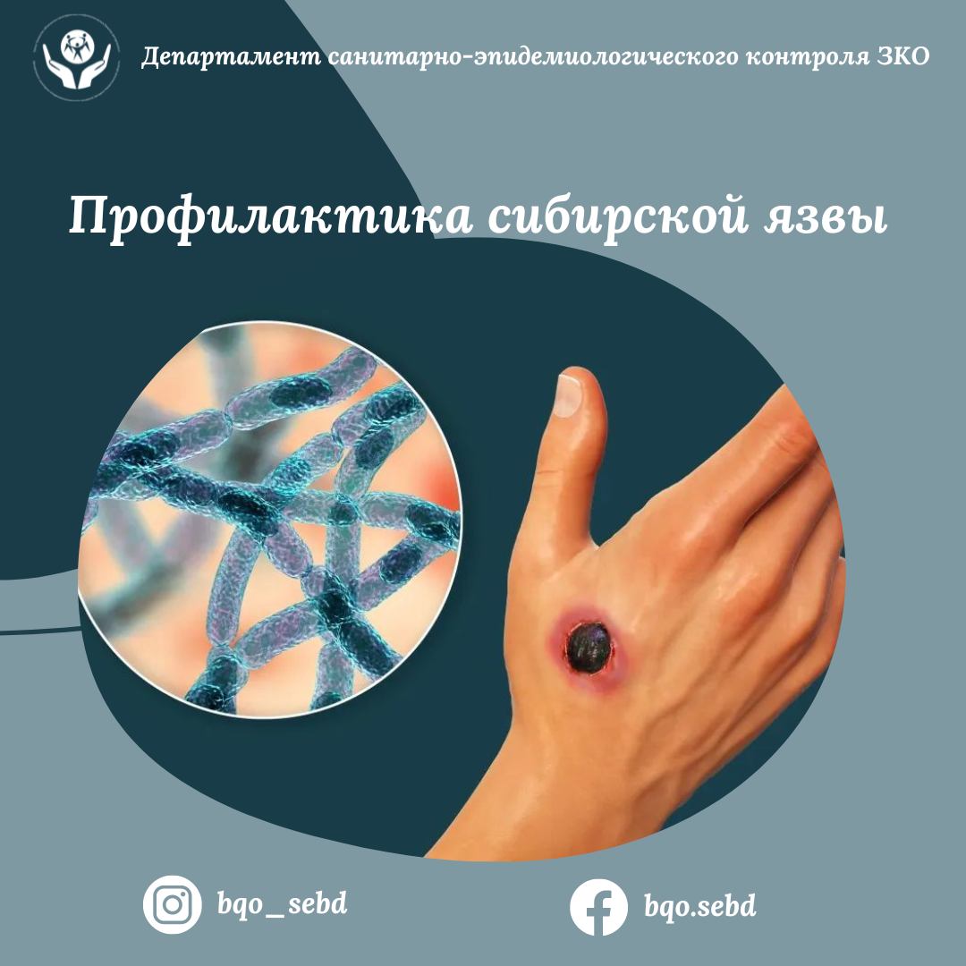 Профилактика сибирской язвы