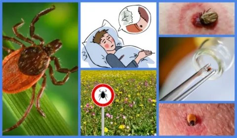 Порно жұлдыздың суреті