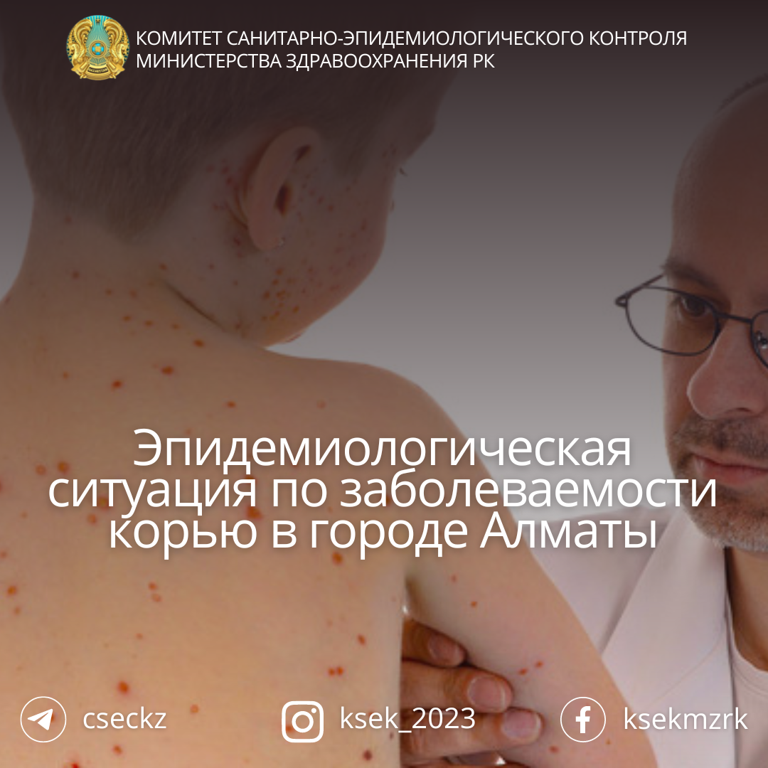Эпидемиологическая ситуация по заболеваемости корью в городе Алматы