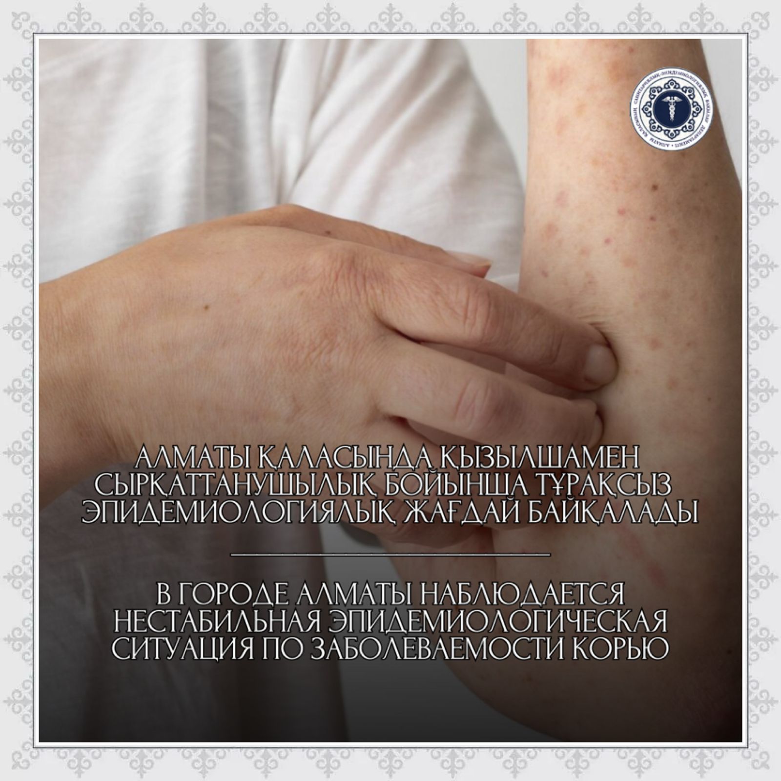 В городе Алматы наблюдается нестабильная эпидемиологическая ситуация по заболеваемости корью