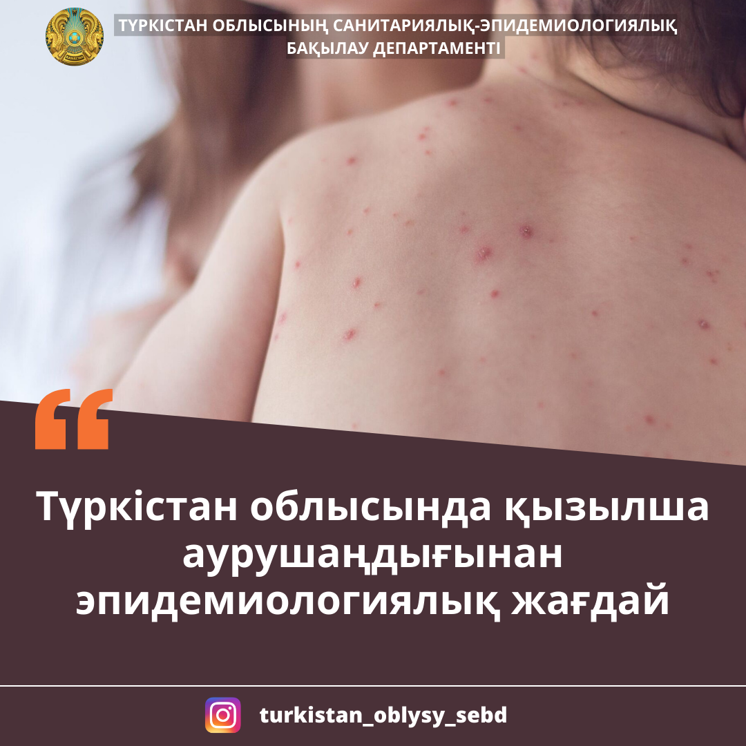 Түркістан облысында қызылша аурушаңдығынан эпидемиологиялық жағдай