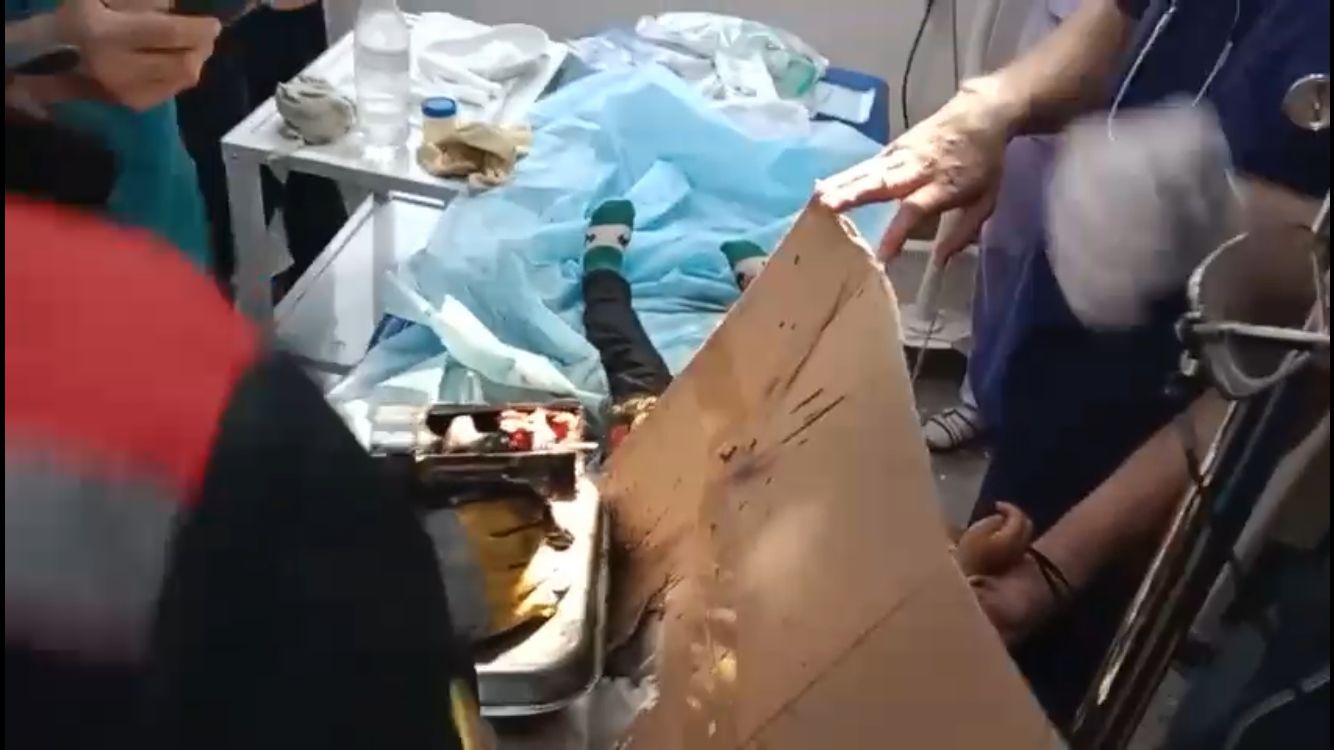 Шымкентте құтқарушылар дәрігерлерге баланың қолын электр тартқыштан босатуға көмектесті