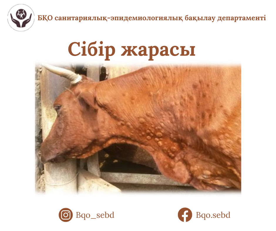Сібір жарасы