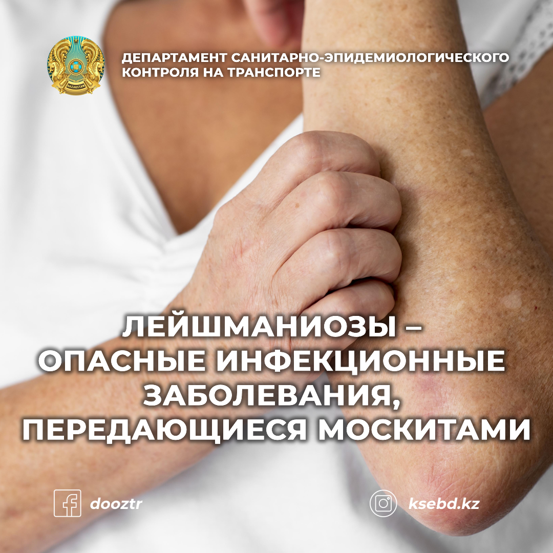 Лейшманиозы – опасные инфекционные заболевания, передающиеся москитами