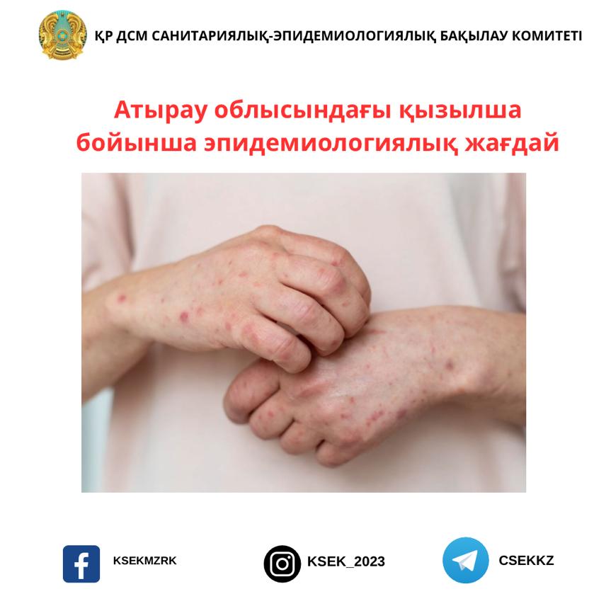 Атырау облысындағы қызылша бойынша эпидемиологиялық жағдай