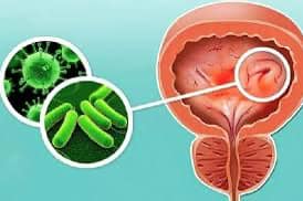 Түркия және порно