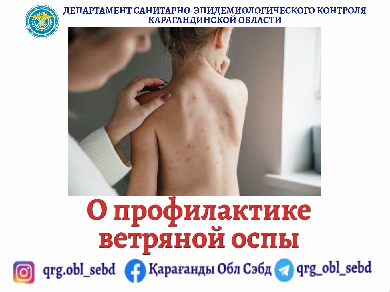 О профилактике ветряной оспы
