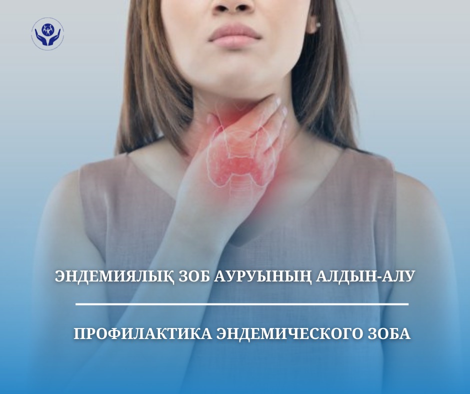 Эндемиялық зоб ауруының алдын-алу