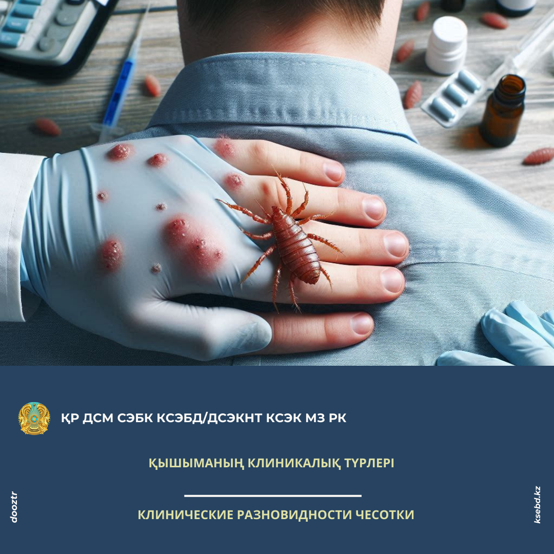 Қышыманың клиникалық түрлері