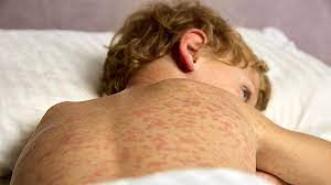 Тегіс кисканың фотосы