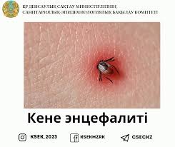 Кене энцефалиті